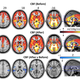 Illustration for article titled Magic Mushroom Chemical Appears to Physically Change Depressed Brains